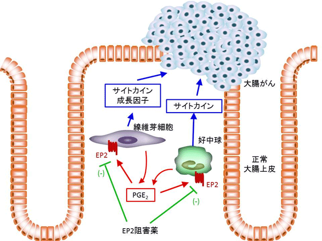 京都大学阐明炎症性大肠癌的致病机制