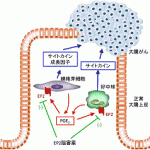 京都大学阐明炎症性大肠癌的致病机制