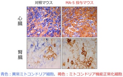 日本研究发现一种可有效治疗线粒体疾病的化合物