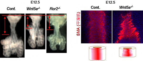 Wnt5a及Ror2基因变异小鼠的气管形态异常