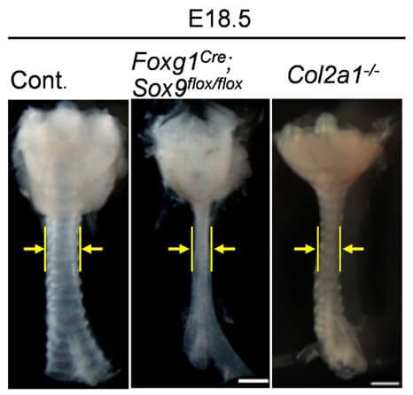 组织特异性Sox9基因变异小鼠与Collagen 2a1基因变异小鼠的气管狭窄形态