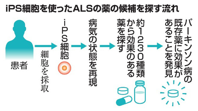 iPS细胞筛选ALS候选药物流程