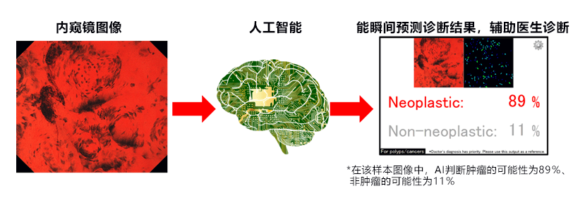 日本昭和大学开发配备AI辅助诊断软件的内窥镜，已通过审批