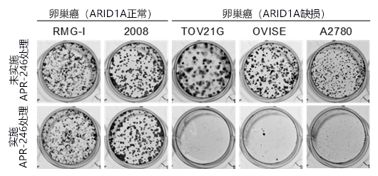 日本发现治疗ARID1A基因突变癌症的新方法