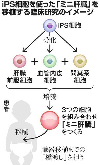 日本iPS细胞研究报告(廿六) 横滨市大篇：肝芽移植临床申请