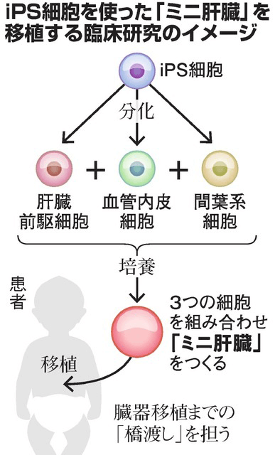 日本iPS细胞研究报告(廿六) 横滨市大篇:肝芽移植临床申请