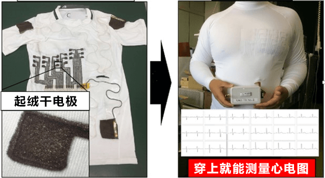 产综研与名古屋大学开发出能测量心电图的智能服装
