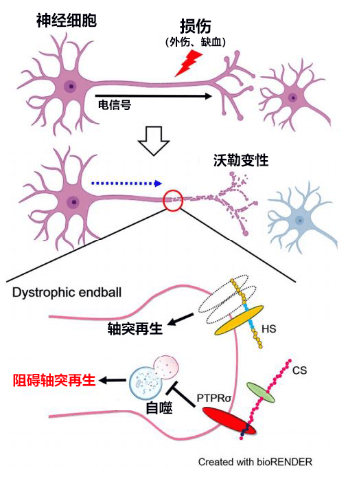 名古屋大学与台湾研究机构合作查明阻碍神经轴突再生的分子机制