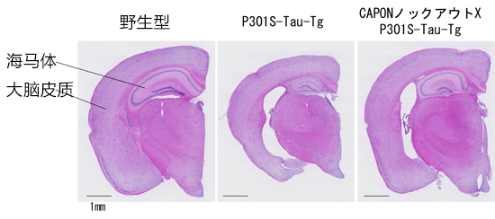 日本理研发现导致阿尔茨海默病恶化的蛋白质