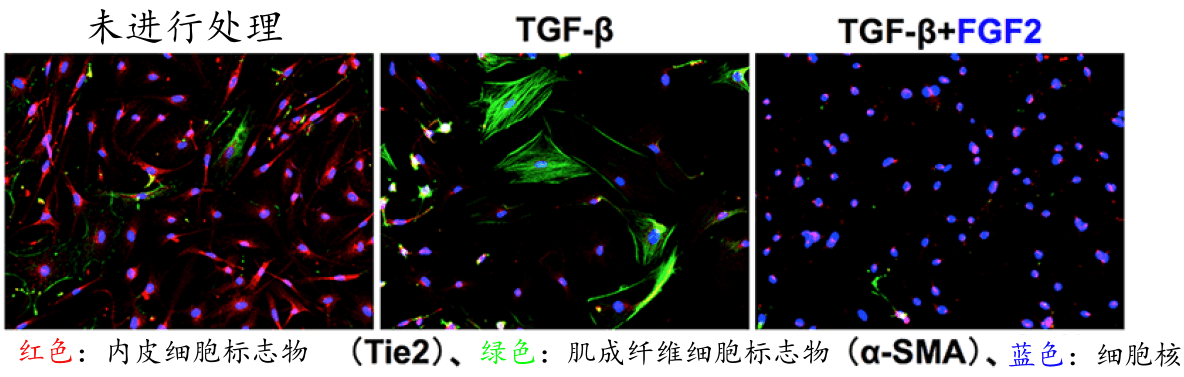 日本查明FGF2能抑制血管内皮细胞形成肿瘤相关成纤维细胞