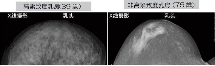 神户大学开发成功新型微波乳腺癌诊断仪