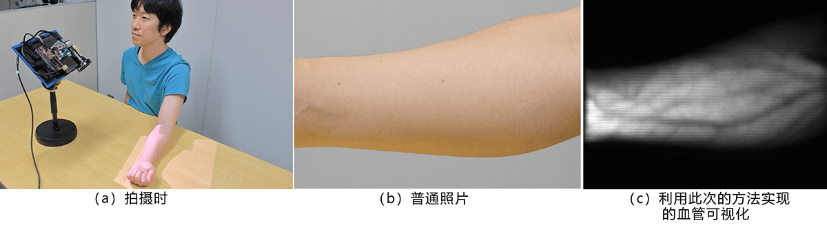 日本开发出非接触实时清晰显示皮下血管的技术，有望应用于注射、采血等医疗用途