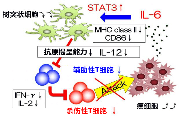 日本查清促进大肠癌肝转移的新控制机制，阻断IL-6信号有望抑制转移