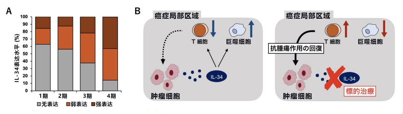 日本首次查明IL-34加大卵巢癌恶性度，有望开发靶向IL-34的卵巢癌新疗法