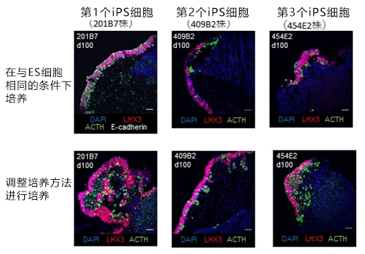 日本成功用人源iPS细胞制成功能性下丘脑-垂体单元