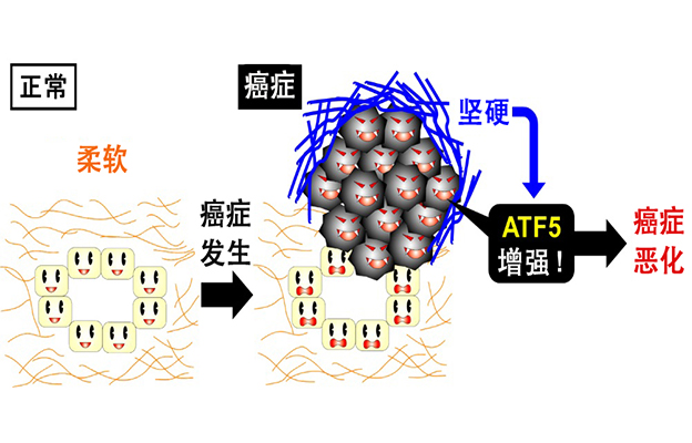 北海道大学发现癌症恶化机制，关键在于癌症组织的“硬度”