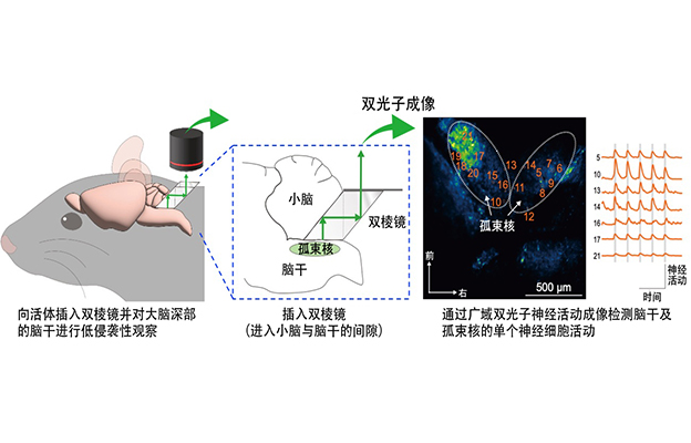 日本生理研开发出大脑深部孤束核活体成像法，为精神疾病治疗开辟道路