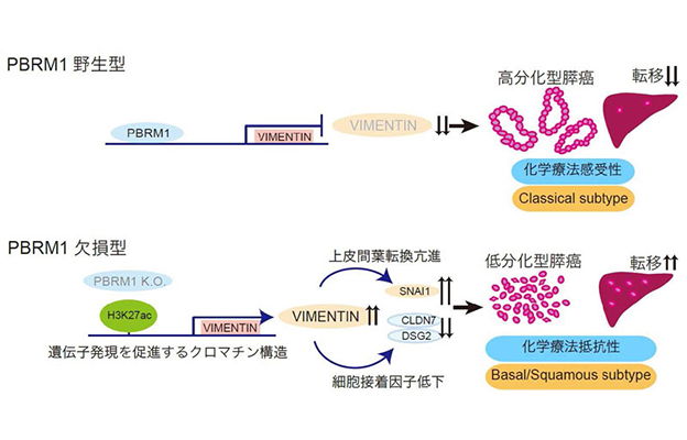 京都大学发现特定蛋白质或参与胰腺癌恶性进展