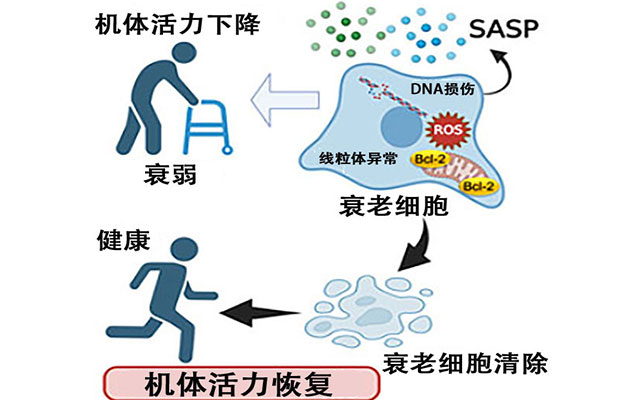 京都大学开发出清除衰老细胞的新型疗法，有望减轻慢性炎症并改善年龄相关性疾病