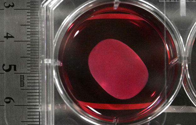 iPS细胞再生医疗产品或3月上旬在日获批