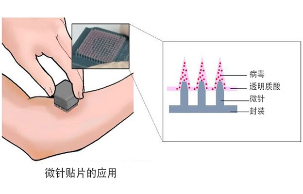 东京大学开发出新冠疫苗微针贴片，旨在实现自我接种和常温运输