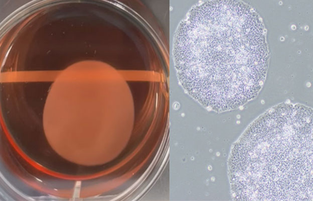 iPS细胞再生医疗产品在日本首次获批，心力衰竭等疾病的治疗选择将增加