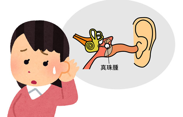 慈惠医科大学发现治疗急性白血病的药物对难治性慢性中耳炎有效