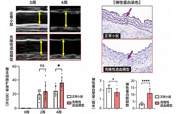 名古屋大学明确衰老导致主动脉瘤恶化的机制，为以免疫细胞为靶点的药物治疗策略开辟道路