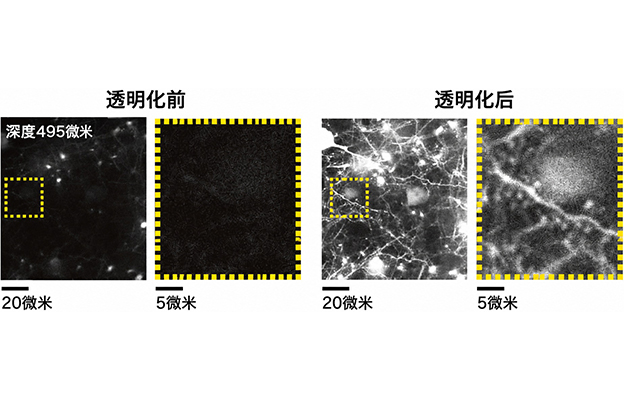 九州大学：实现活体哺乳动物生物组织的透明化及观察，通过调节细胞外液的折射率来推动神经科学发展
