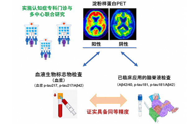 新潟大学等证实血液标志物“p-tau217”可高精度检测脑内β淀粉样蛋白蓄积，为低侵袭、高效率的阿尔茨海默病诊断开辟道路