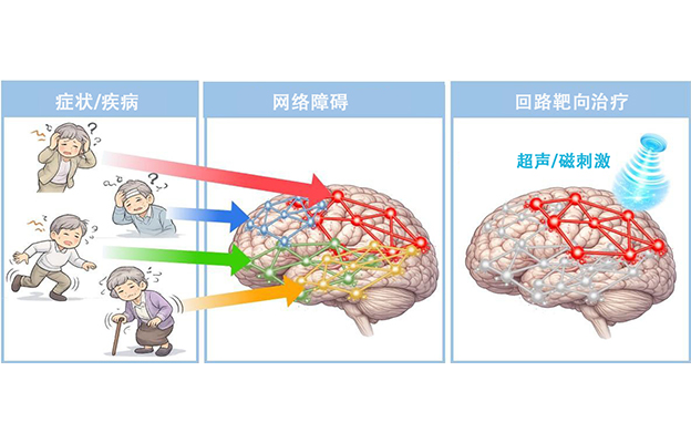 QST阐明tau蛋白病变通过脑回路引发认知症状，有望实现痴呆症预测与靶向回路治疗