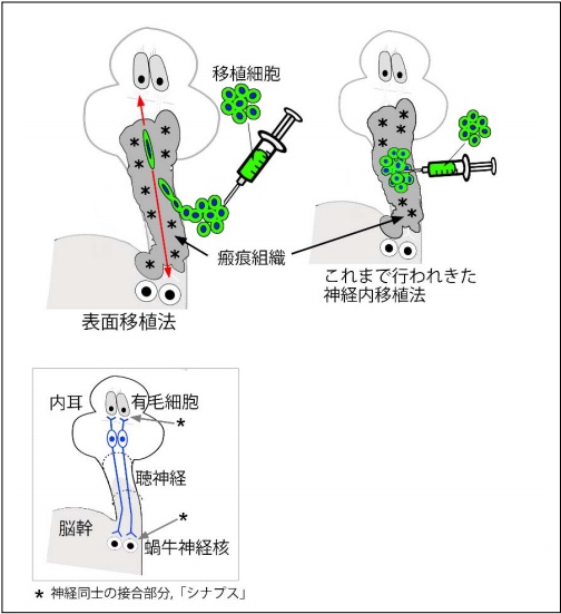 京都大学成功利用新细胞移植技术恢复听觉神经机能