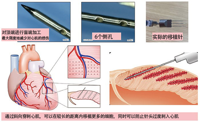 大学初创企业表彰2021文部科学大臣奖 利用ips细胞开发治疗重度心力衰竭的新疗法 客观日本