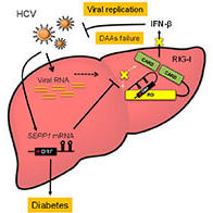 金泽大学查明对于丙肝并发二型糖尿病干扰素治疗效果差的机理