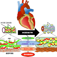 全球首次！日本查明心脏淋巴流与心绞痛之间的关系
