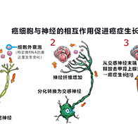 日美合作查清癌细胞与神经的相互作用