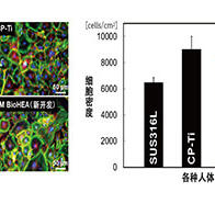 大阪大学开发出高强度且适应身体的活体骨骼替代材料，通过3D金属打印机制造