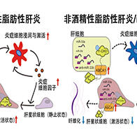 京都大学发现抑制miR-33b可改善非酒精性脂肪性肝炎