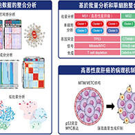 东京科学大学等证实：血管生成抑制剂联合免疫CP抑制剂对MTM/VECT型肝癌有效，为恶性肝癌治疗提供新策略