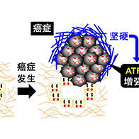 北海道大学发现癌症恶化机制，关键在于癌症组织的“硬度”