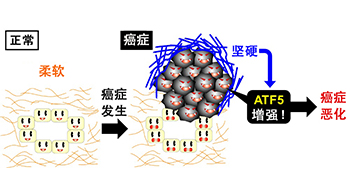 北海道大学发现癌症恶化机制，关键在于癌症组织的“硬度”
