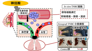 近畿大学发现神经酸对难治性乳腺癌有效，可通过饮食亚麻籽油、鱼油等获得
