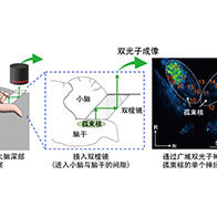 日本生理研开发出大脑深部孤束核活体成像法，为精神疾病治疗开辟道路