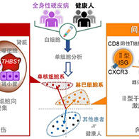 大阪大学发现通过白细胞的单细胞分析可预测罕见病“全身性硬皮病”的致命性重症