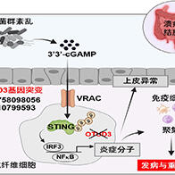 大阪大学阐明溃疡性结肠炎的发病与重症化机制，OTUD3可调控肠道细菌诱导的炎症反应