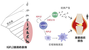 京都大学鉴定出类风湿关节炎中灵长类特异性的新型细胞因子，或为类风湿关节炎治疗提供关键线索