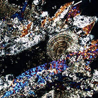 如银河般璀璨的尿路结石晶体：应用陨石研究方法解读人体内部环境