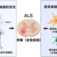 大阪大学：ALS患者脊髓运动神经中存在“过度兴奋”及“与其他细胞的协作障碍”