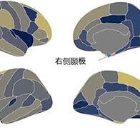 福井大学：儿童使用信息终端的时间与ADHD症状相关，对大脑构造有影响
