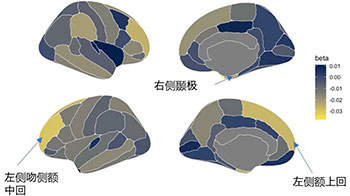 福井大学：儿童使用信息终端的时间与ADHD症状相关，对大脑构造有影响